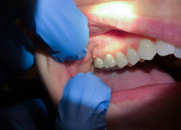 Best Broken or Chipped Tooth Repair in One Loudoun, VA